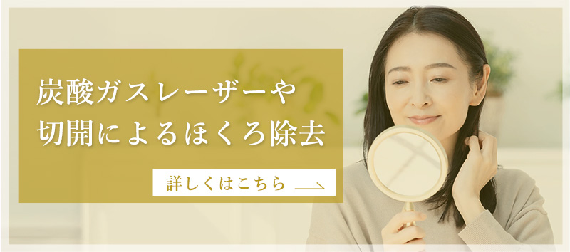 炭酸ガスレーザーや切開によるほくろ除去